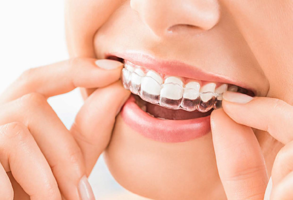 Clínica dental Getxo Algorta - Dentista Getxo Las Arenas - Ortodoncia invisible Invisalign - Implantes dentales